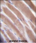 VEGF3 Antibody (N-term)